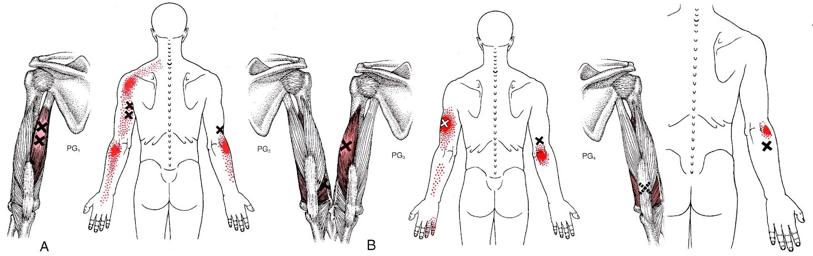 ondas de choque córdoba